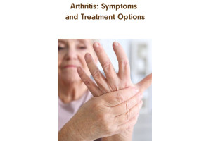 Arthritis: Symptoms and Treatment Options