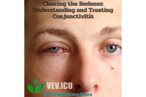 Clearing the Redness: Understanding and Treating Conjunctivitis