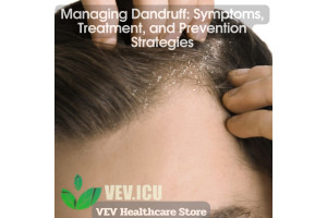 Managing Dandruff: Symptoms, Treatment, and Prevention Strategies