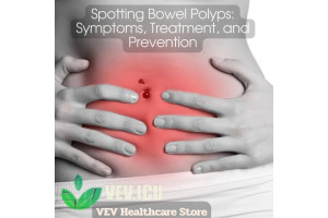Spotting Bowel Polyps: Symptoms, Treatment, and Prevention