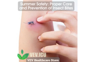 Summer Safety: Proper Care and Prevention of Insect Bites