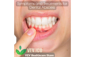 Symptoms and Treatments for Dental Abscess