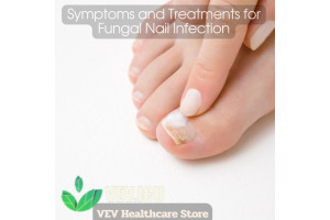Symptoms and Treatments for Fungal Nail Infection