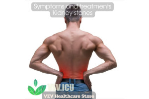 Symptoms and treatments Kidney stones
