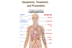 Understanding Leptospirosis: Symptoms, Treatment, and Prevention