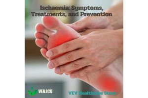 Ischaemia: Symptoms, Treatments, and Prevention