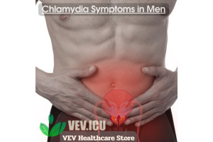 Chlamydia Symptoms in Men