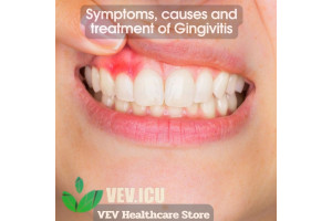 Symptoms, causes and treatment of Gingivitis