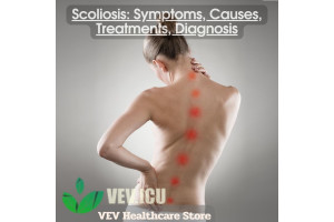 Scoliosis: Symptoms, Causes, Treatments, Diagnosis