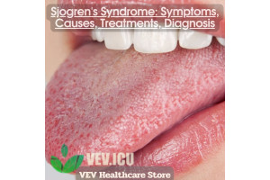 Sjogren's Syndrome: Symptoms, Causes, Treatments, Diagnosis