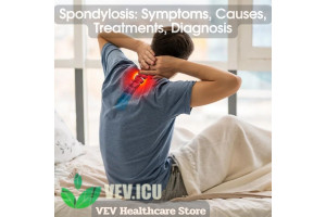 Spondylosis: Symptoms, Causes, Treatments, Diagnosis 