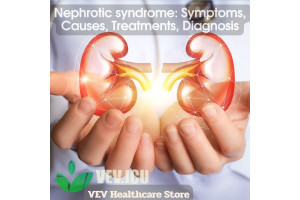 Nephrotic syndrome: Symptoms, Causes, Treatments, Diagnosis