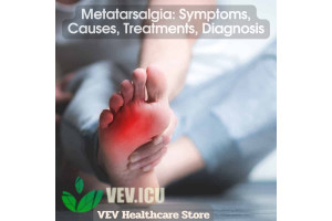 Metatarsalgia: Symptoms, Causes, Treatments, Diagnosis