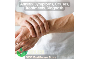 Arthritis: Symptoms, Causes, Treatments, Diagnosis