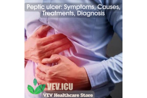 Peptic ulcer: Symptoms, Causes, Treatments, Diagnosis