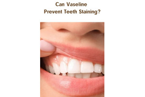 Can Vaseline Prevent Teeth Staining?