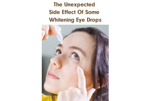 The Unexpected Side Effect Of Some Whitening Eye Drops