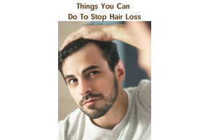 Things You Can Do To Stop Hair Loss