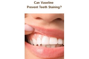 Can Vaseline Prevent Teeth Staining?