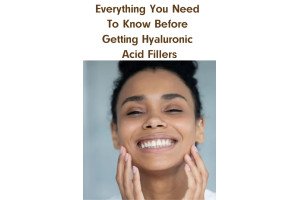 Everything You Need To Know Before Getting Hyaluronic Acid Fillers