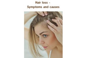 Hair loss - Symptoms and causes