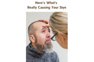 Here's What's Really Causing Your Stye