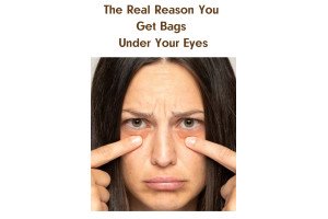 The Real Reason You Get Bags Under Your Eyes