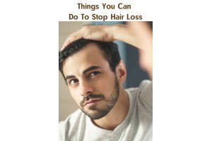 Things You Can Do To Stop Hair Loss